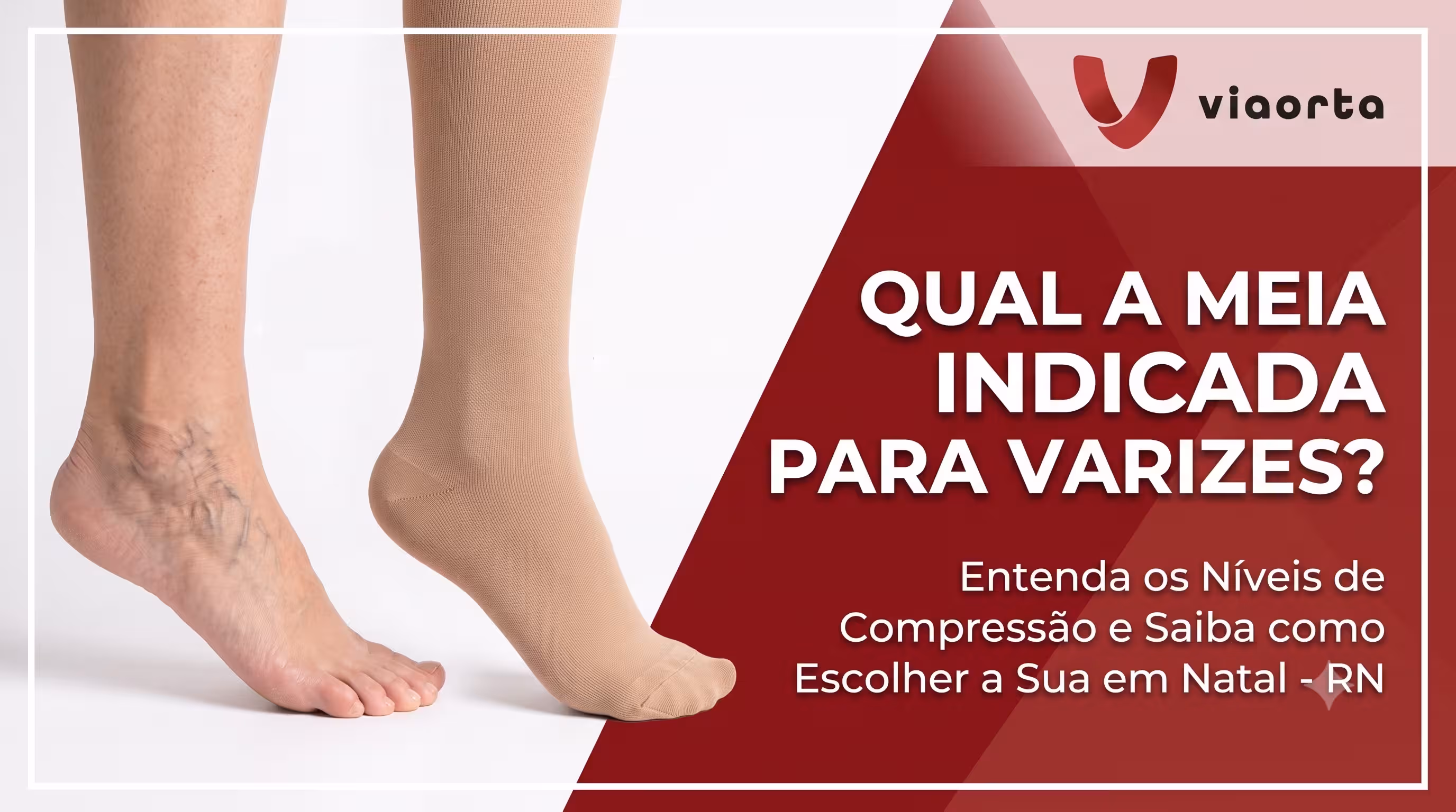Qual a meia indicada para quem tem varizes? Saiba como escolher em Natal - RN