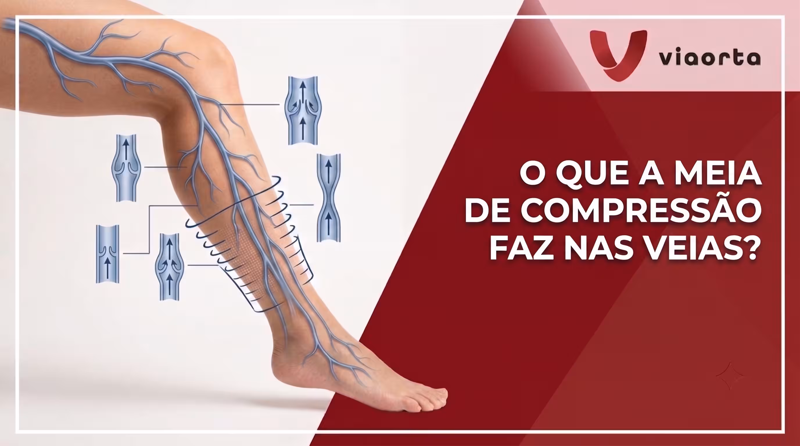 O que a meia de compressão faz nas veias?
