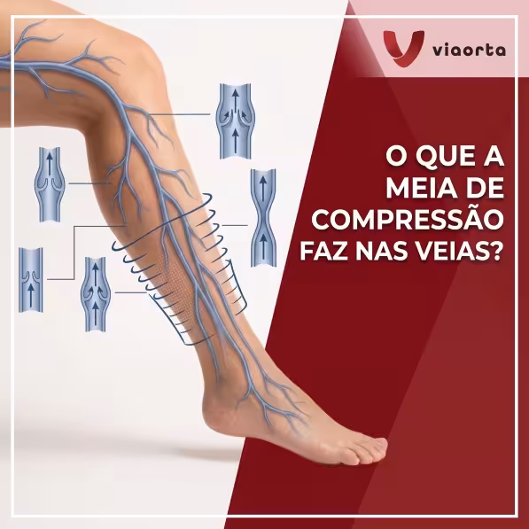 O que a meia de compressão faz nas veias?