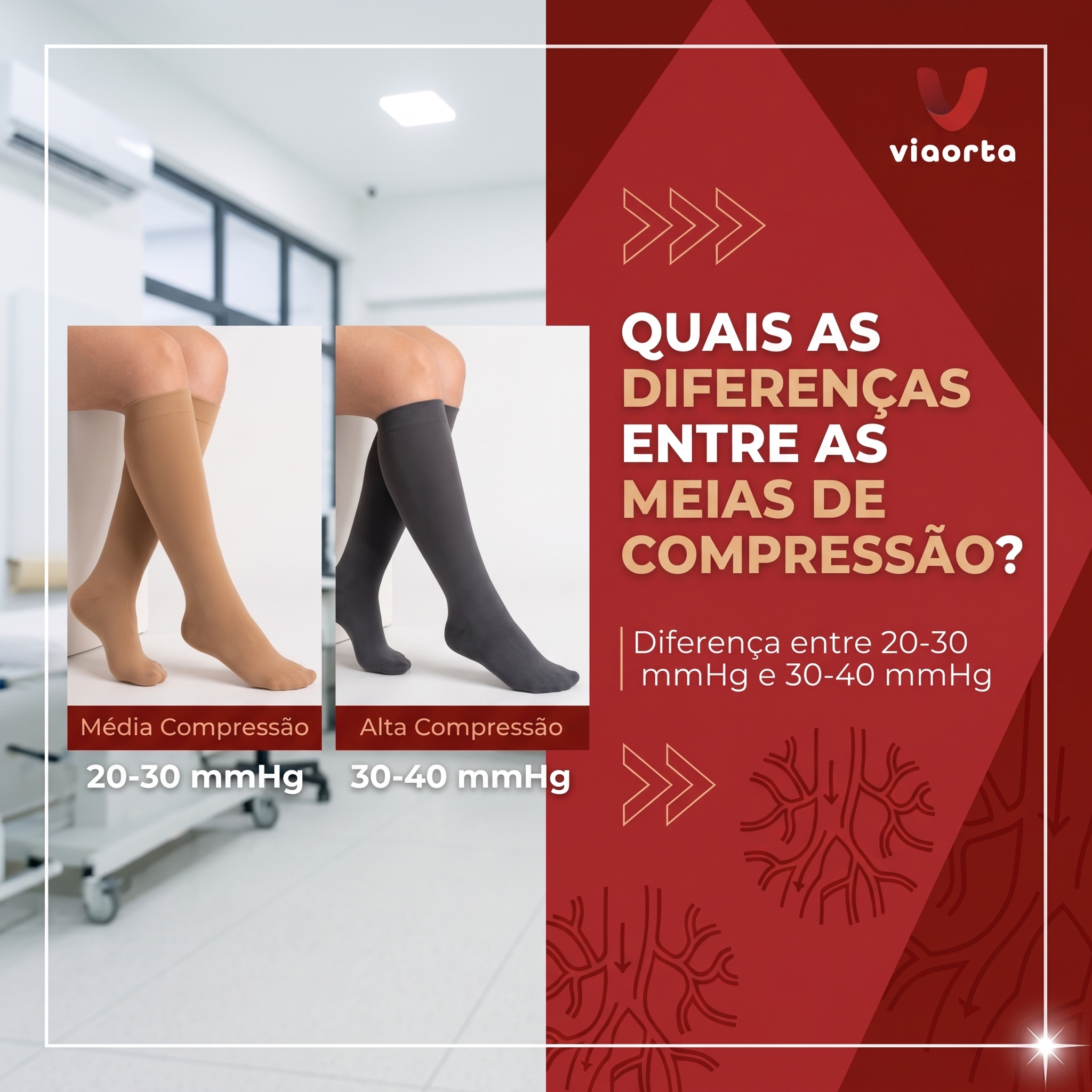 Quais as diferenças entre as meias de compressão 20-30 mmHg e 30-40 mmHg?